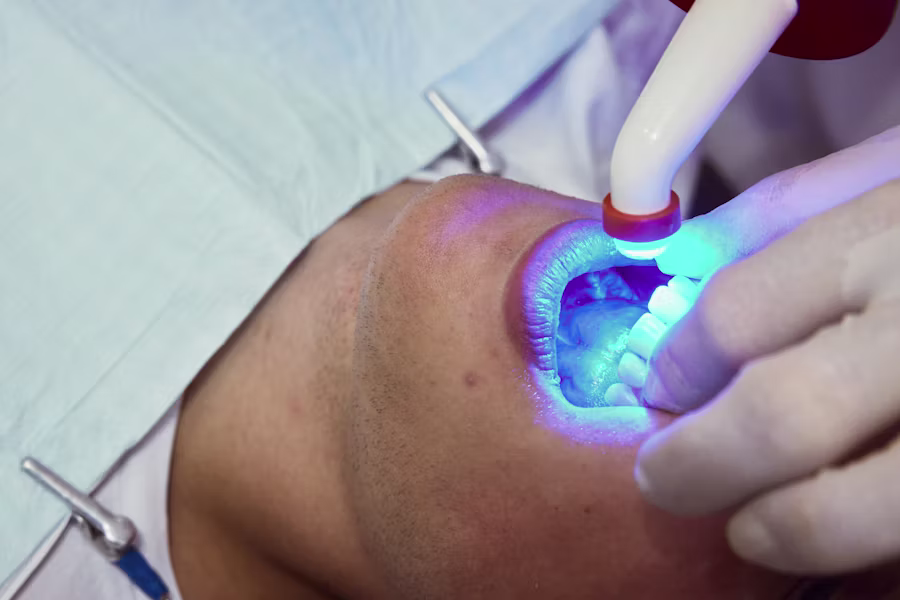 Sbiancamento denti professionale in studio — Studio Odontoiatrico Mengoni